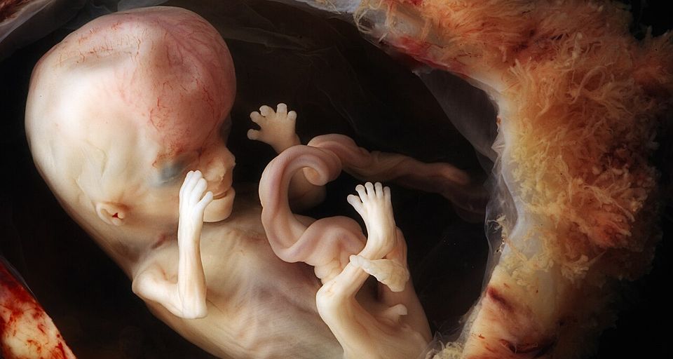 Semanas 9–10 · ≈ 3,6 cm: Ya es feto: empieza el periodo fetal